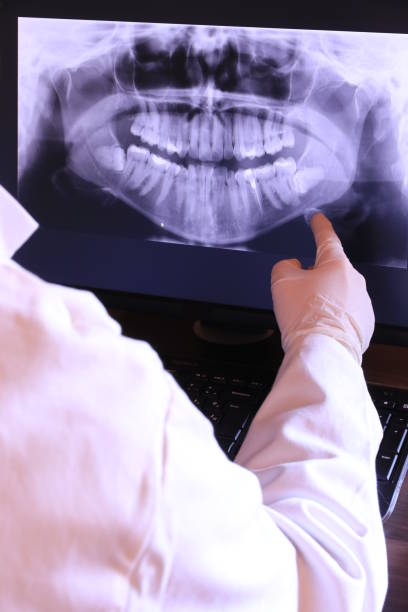 Best Broken or Cracked Tooth Emergency Dentist in Lowell, MI