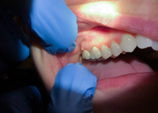 Best Emergency Dental Services for Seniors in Lowell, MI