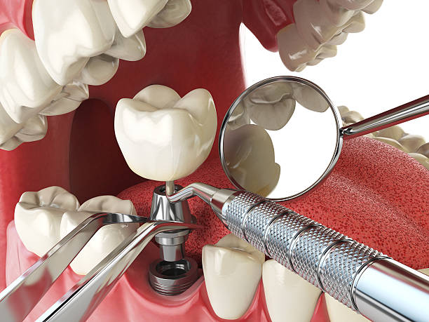 Lowell, MI Emergency Dentist Pros